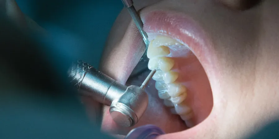 Best Dental Clinic in Hyderabad