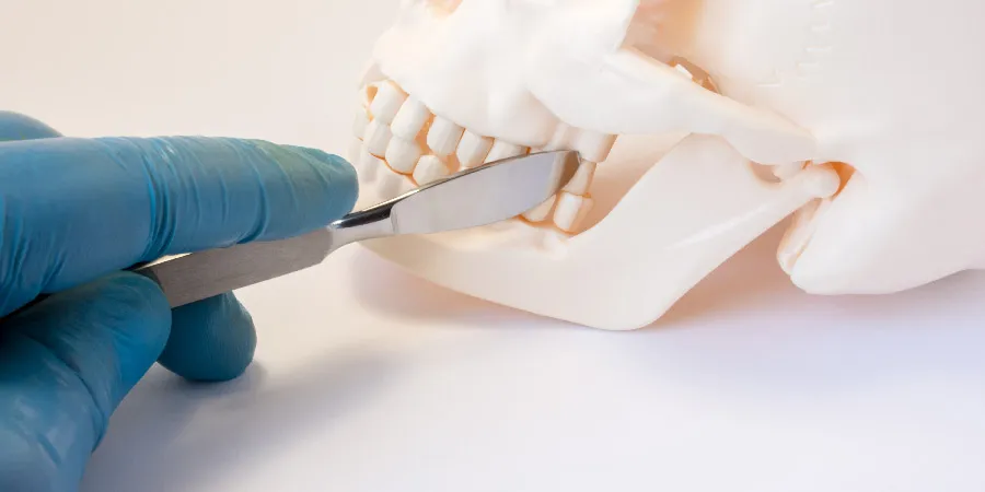 Top Dentists in Hyderabad