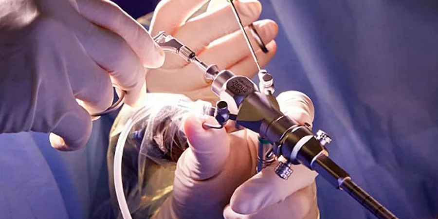 Endoscopic Brain Surgery