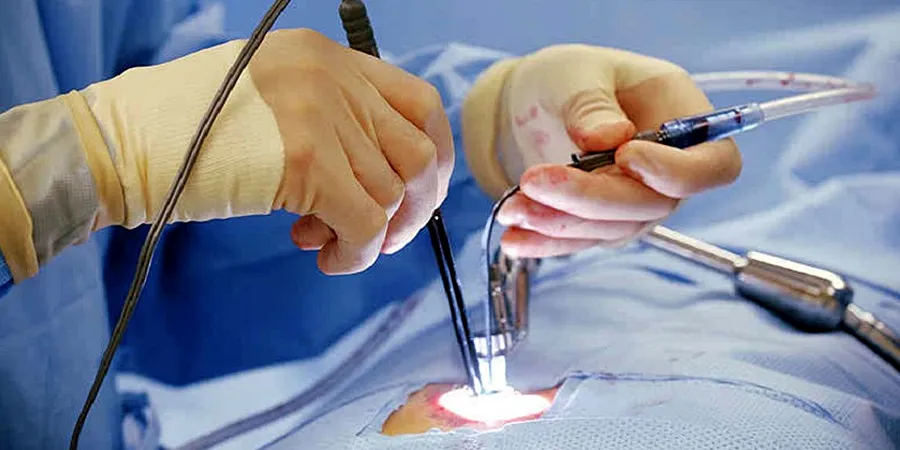 Endoscopic spine surgery