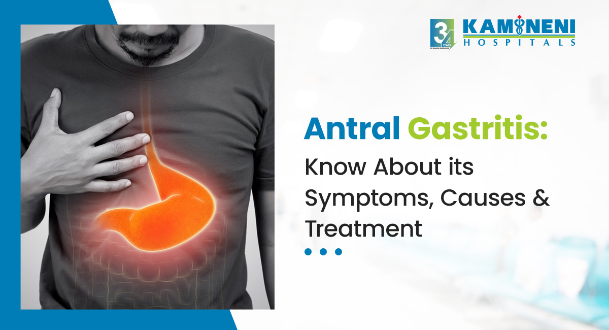 antral gastritis treatment