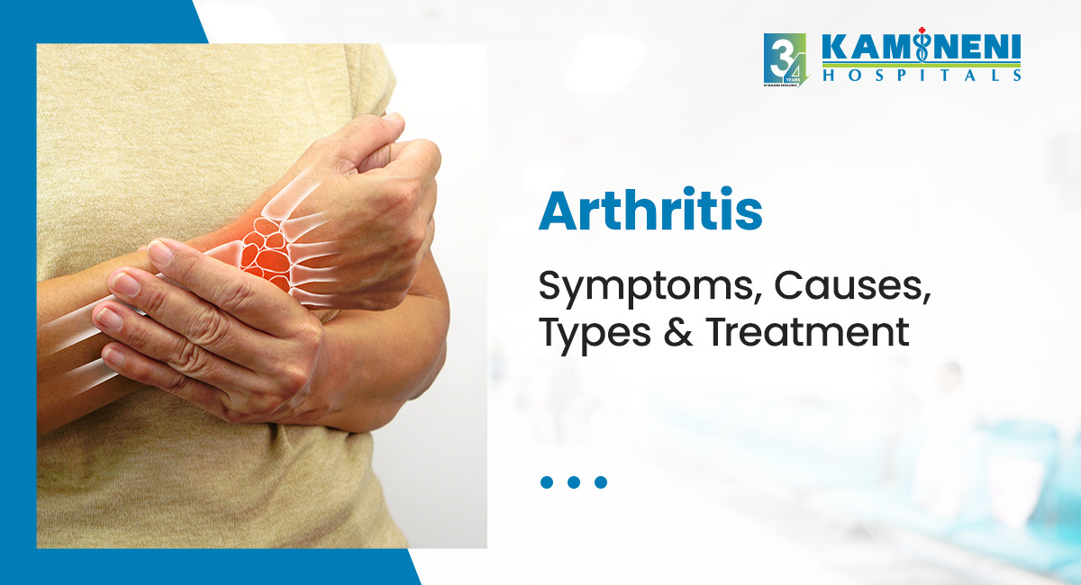 arthritis