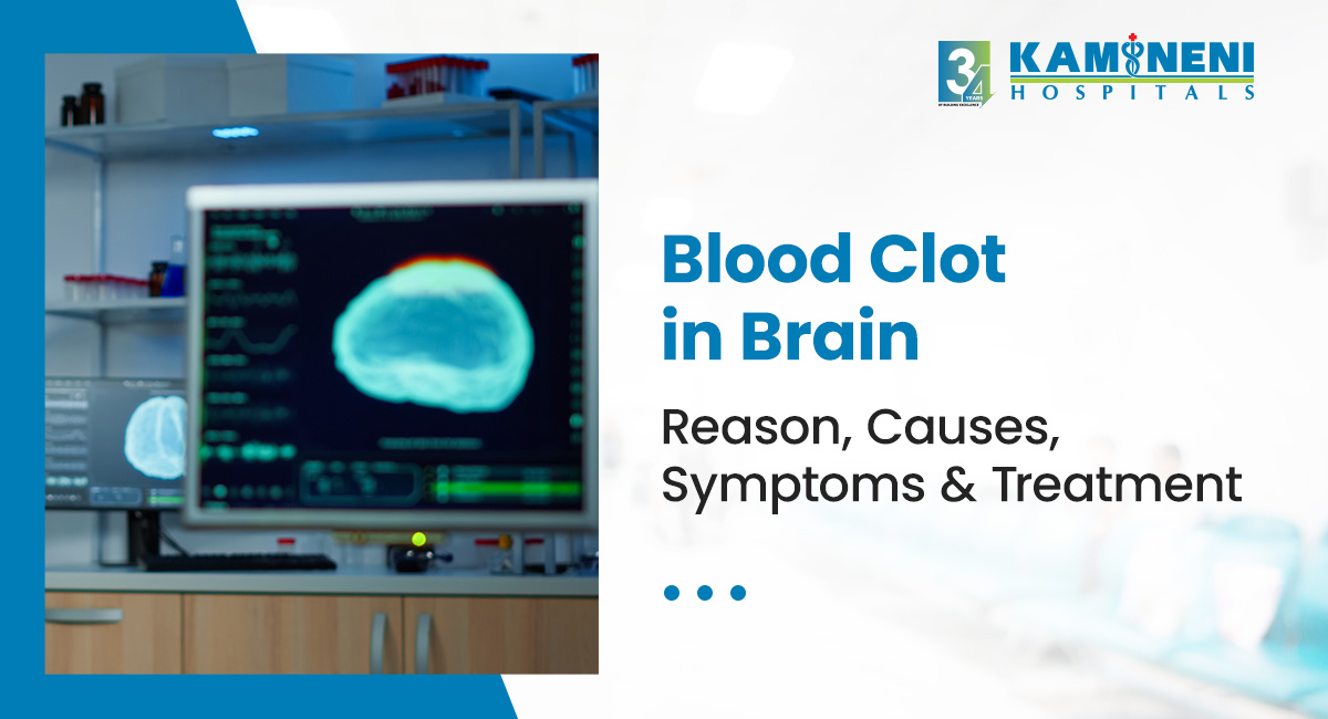 blood clot in brain