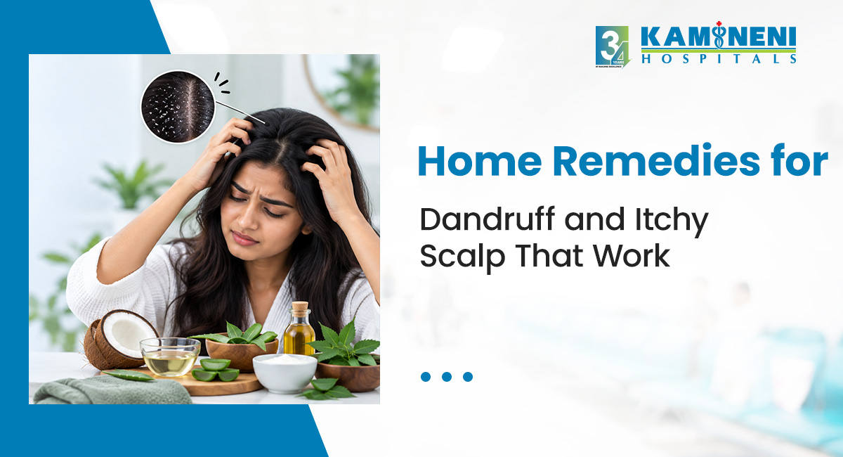 home remedy dandruff